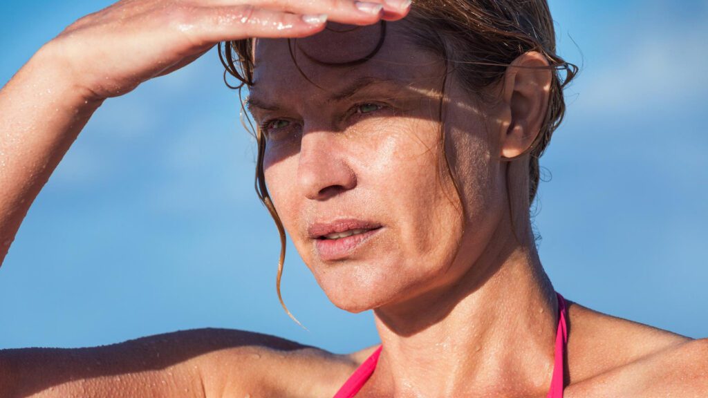 Lady on the beach without sun protection