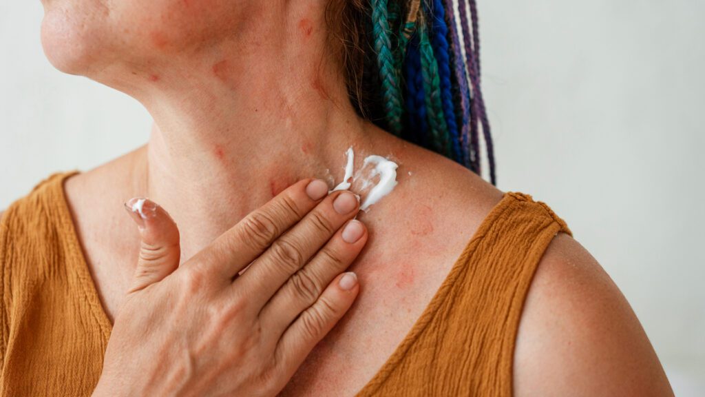 tanning in bed or sun can cause skin cancer