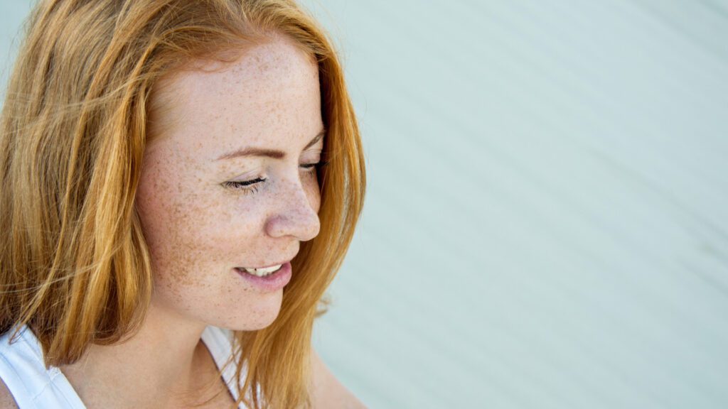 Sun tanning affect freckles