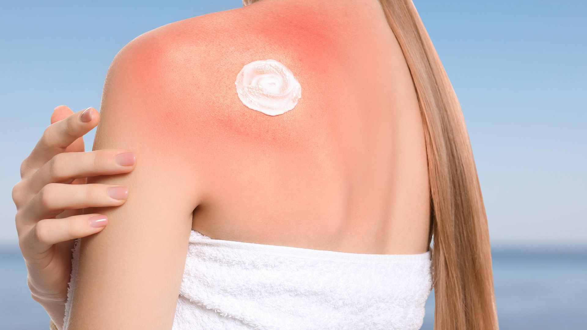 Does Spray Tan Prevent Sunburn?